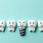 Kiedy robić implant zęba?